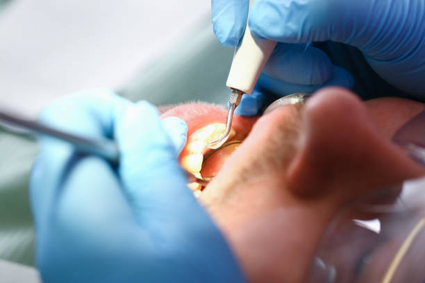 Best Emergency Root Canal Treatment in Forest Park, IL