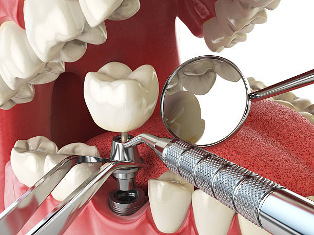 Best Emergency Dentist for Special Needs Patients in Forest Park, IL